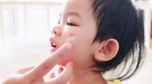 止痒|儿科医生忠告:宝宝被蚊虫叮咬后,家长不要再这样做了