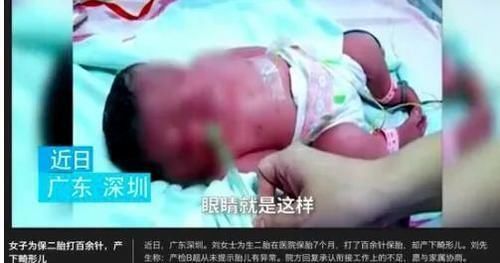 产妇|准妈妈不惜一切的去保护孩子,孩子出生后,产妇却当场被吓晕