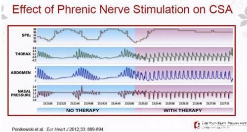 高血压|高血压治疗有了新见解，舒张压不存在“危险低值”