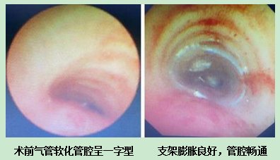 求医路|跨越千里求医路，8月龄的宝宝得到救治