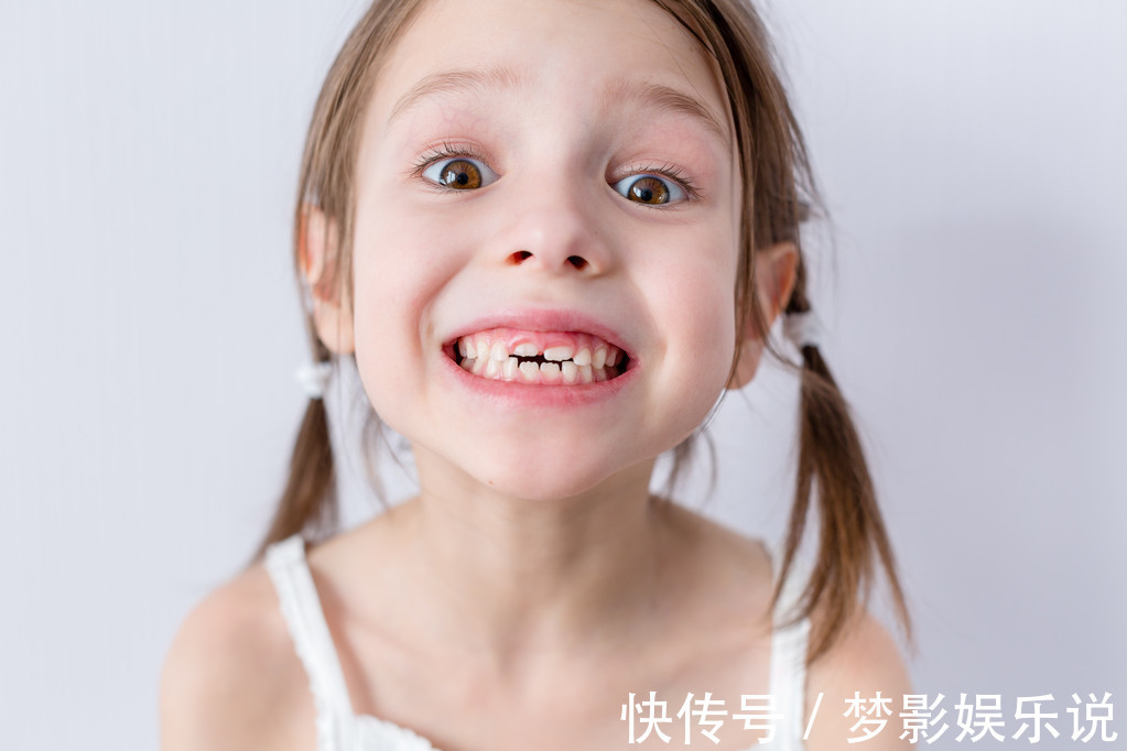 矫正|儿童做牙齿矫正三个最佳时间:家长要牢记,矫治越早干预效果越好