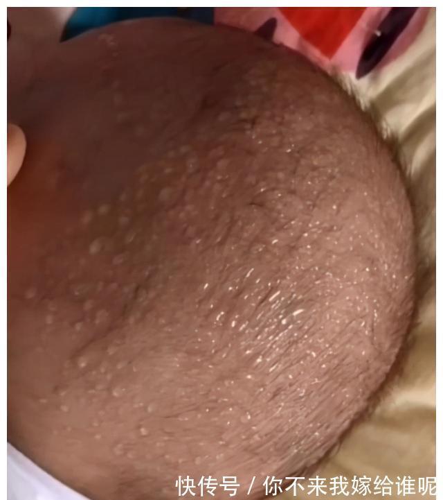 身高|4岁男孩身高已经126公分,医生:这个消食习惯非常好,家长多