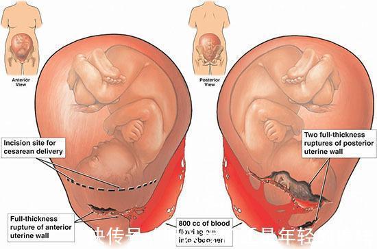 胎儿|子宫里黑漆漆,胎儿在干嘛宝宝视角“妈妈,我忙着呢”