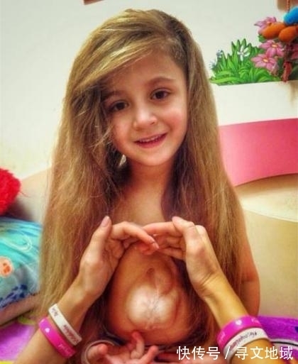 医生|女童心脏长在胸腔外,医生断言活不久,如今已6岁长得特别漂亮