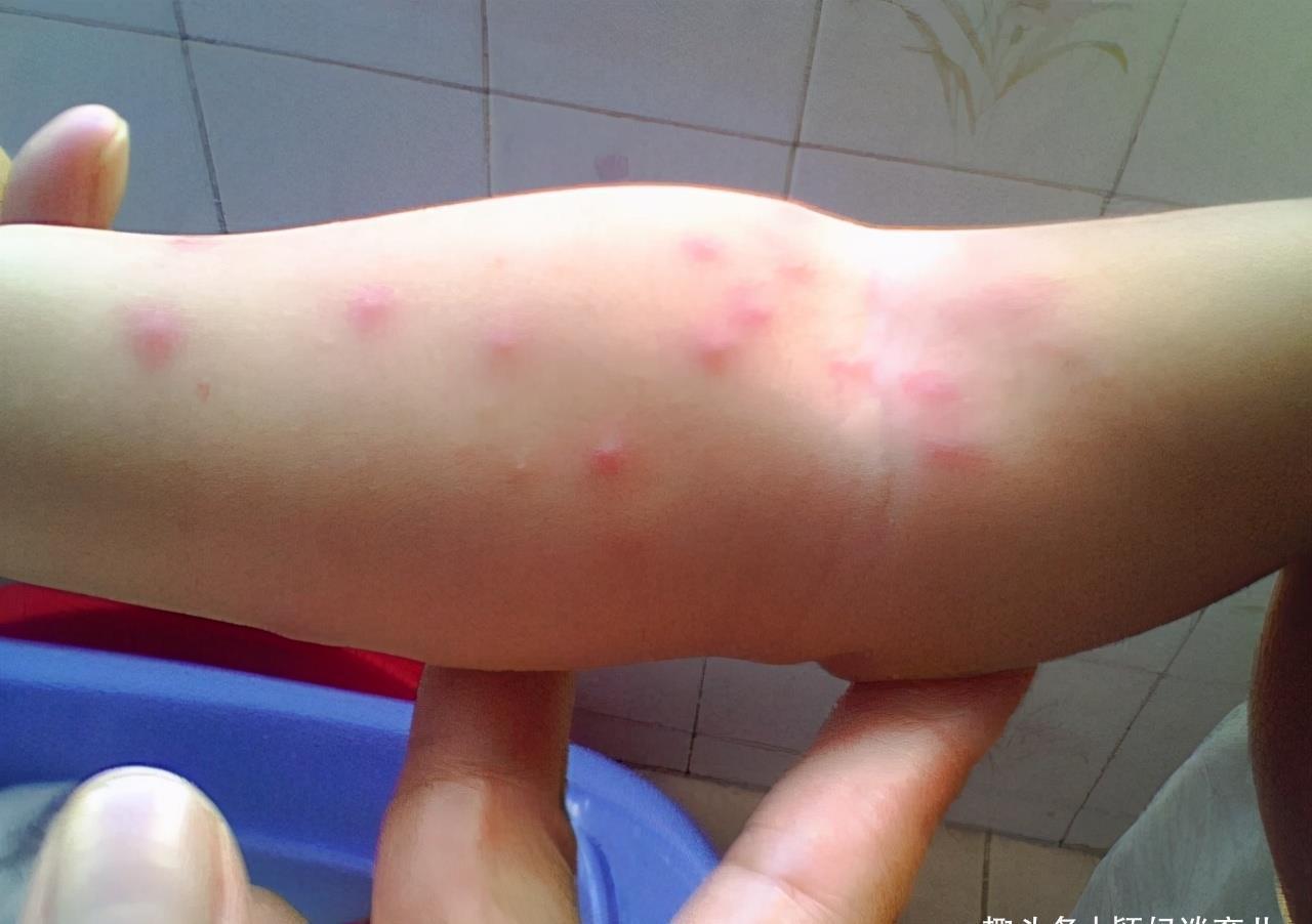 营养均衡|宝宝多大吃虾比较好?太早太晚都不好,听听专家建议