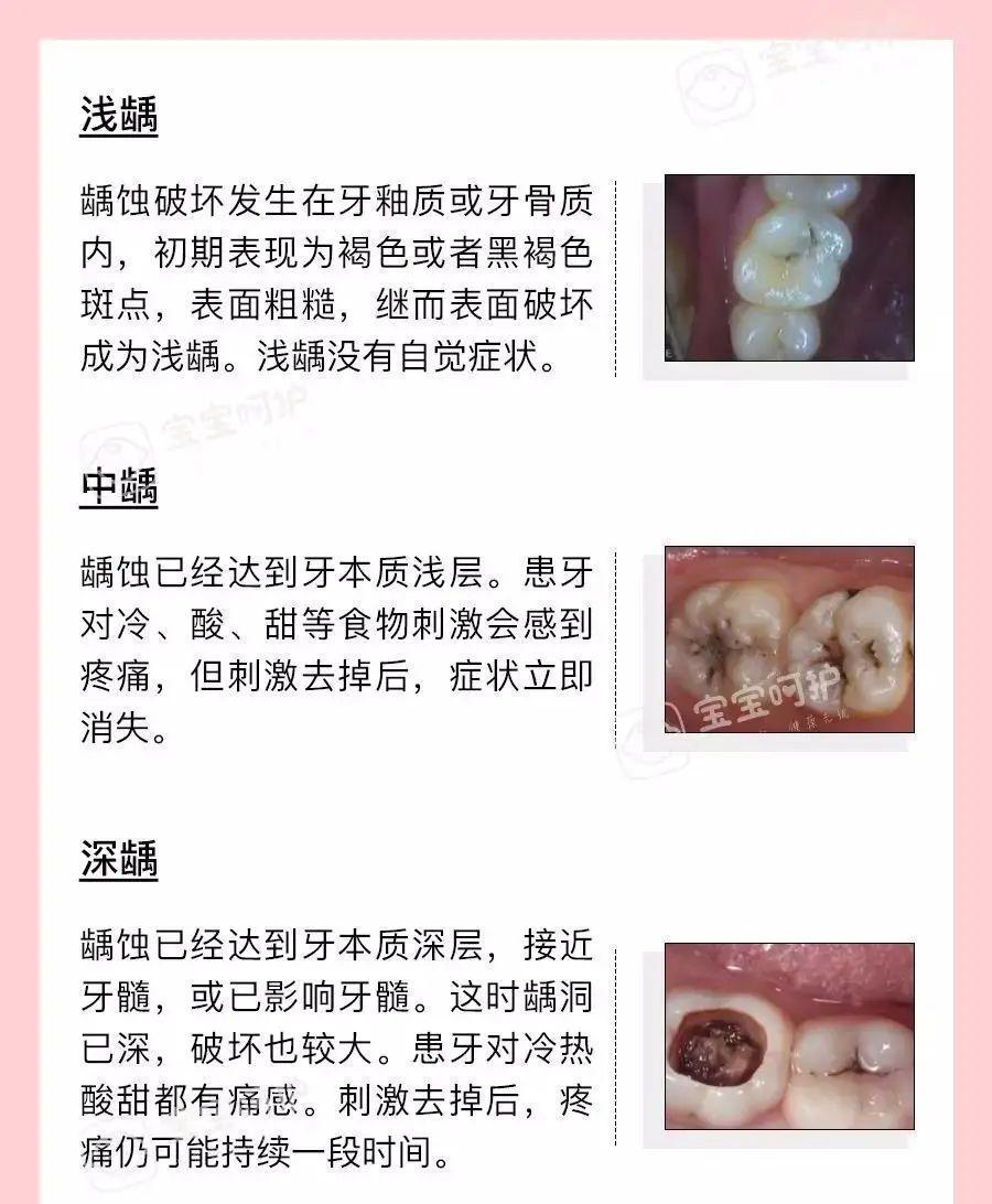 牙齿|不吃糖，孩子却满口烂牙！罪魁祸首竟是它，快看你家有没有