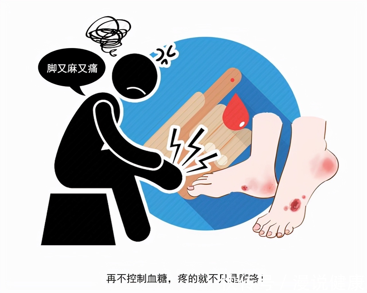 末梢神经|血糖过高,脚部先知?若出现这3个迹象,最好别乱用热水泡脚!