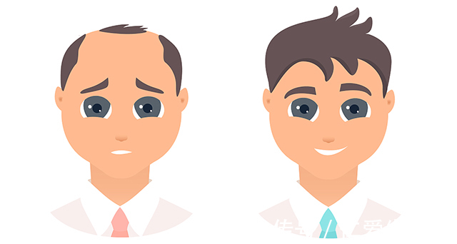 头发|植发效果到底是由什么来判断?