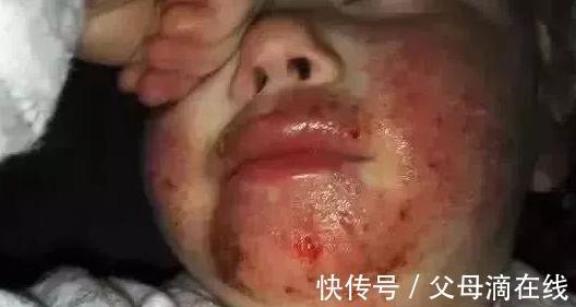 指甲|带孩子出门,第一防人贩子,第二防这种人