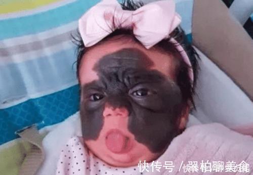 女孩|那个脸上有“蝙蝠”胎记的女孩,如今生活的怎么样?看完很欣慰