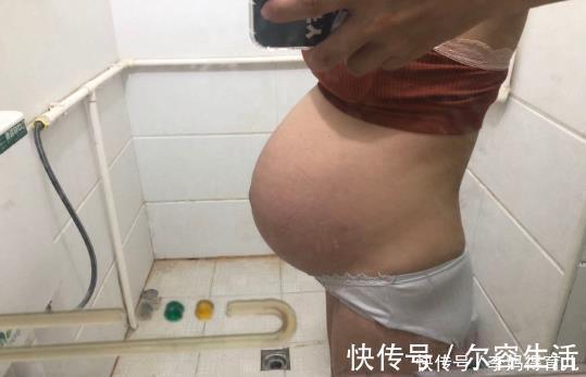 饮食习惯|为什么四维通过了,晚孕却有畸形的情况?原因让人后怕