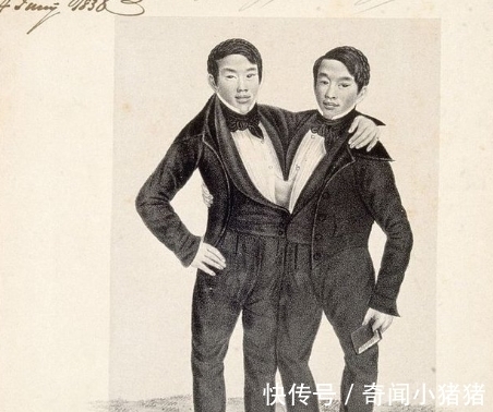 受精卵|连体哥哥爱上英国姑娘，弟弟每次只能回避，姑娘想一招三人都幸福