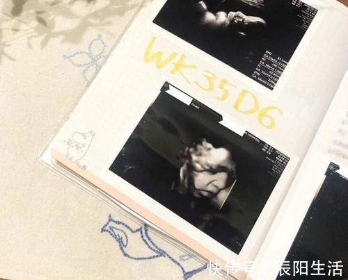 顺产|到底能不能顺产?看最后一次B超,这3个数据已经揭露答案