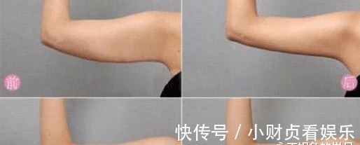 前列腺|男性前列腺,最怕哪些坏习惯?1分钟自测前列腺健康,达标的不多