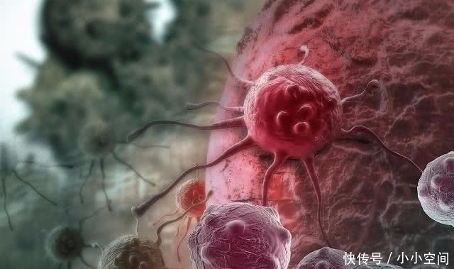 癌细胞|“患癌”的人为什么那么多？或许可以试试“戒掉”4种食物！
