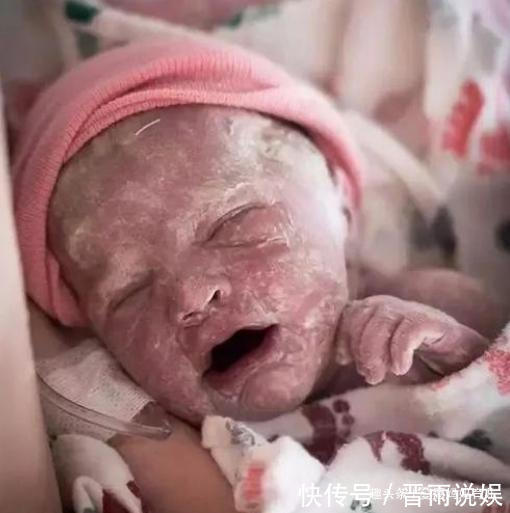 陈芬|宝妈产下“雪娃娃”慌了神,怕丈夫不要娃,护士笑着恭喜她运气好