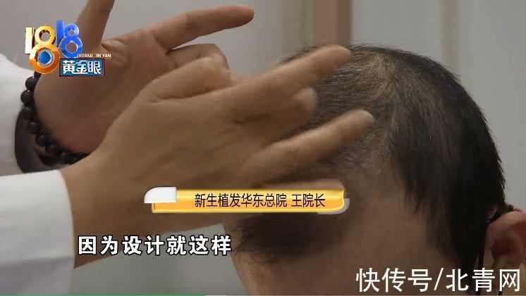 王院长|?植发两年急转直下 质疑“拆东墙补西墙”