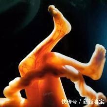 缺钙|胎儿进入身高猛涨期,孕妈身体有4种感觉,忽视娃少长10公分