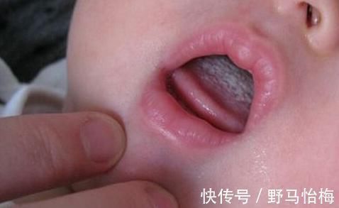 君君|“健脾王”公布了,山药靠边站,孩子若爱吃,消积健脾,长高个