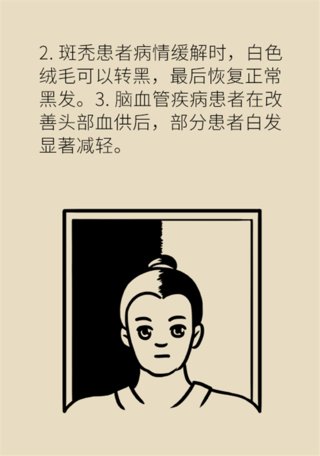 小妙招|年纪轻轻就有白头发？快试试专家这个小妙招！