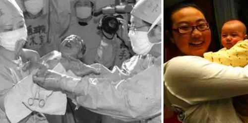 郑桂珍|32年过去了，中国首例“试管婴儿”已经长大生子，如今怎样了