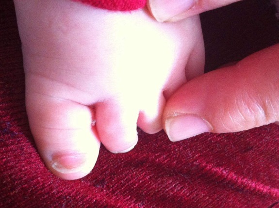 鞋子|3岁宝宝双脚变形,就是因为长时间穿这种鞋子,家长要重视了!