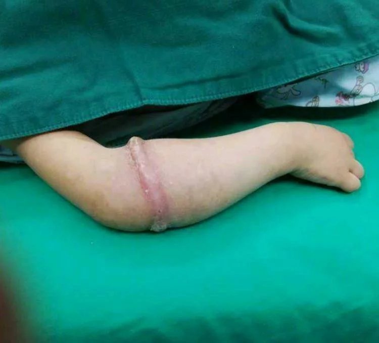 橡皮筋|4岁女孩得怪病,医生检查后,忍不住训斥父母心真大