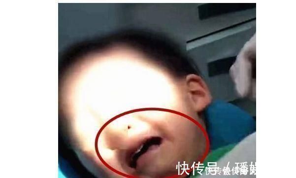 家里面|6岁男童被查出牙龈癌晚期,牙齿掉光了,孩子爱喝家长要警惕