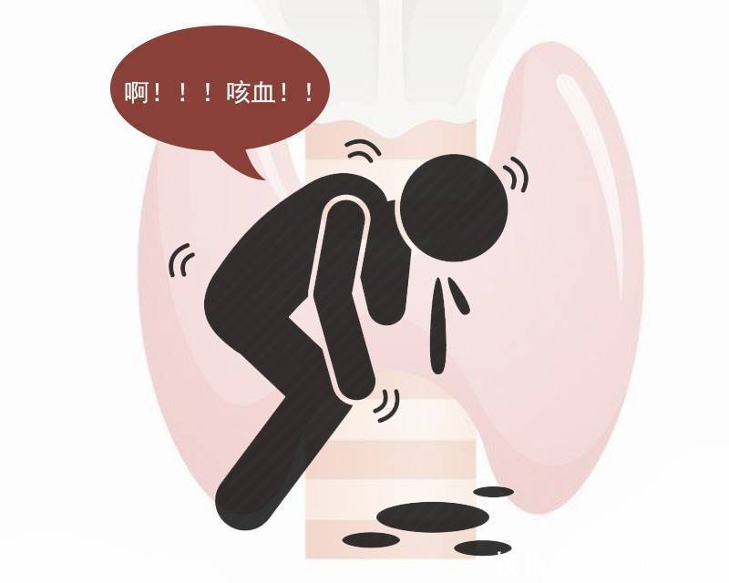 肺部|若这4个症状都出现，保持警惕！肺部或已癌变，3类人不妨自测