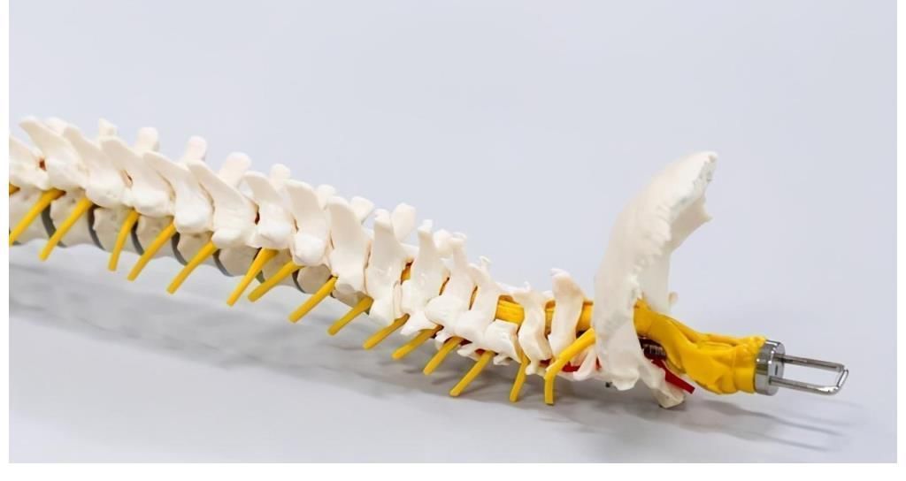 钙质|稳固骨质的“冠军”找到了，不是牛奶，没事敞开吃，提高骨密度