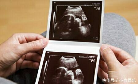 彩超|迫不及待想看孩子,四维彩超时宝宝却比个“v”,医生忍不住笑了