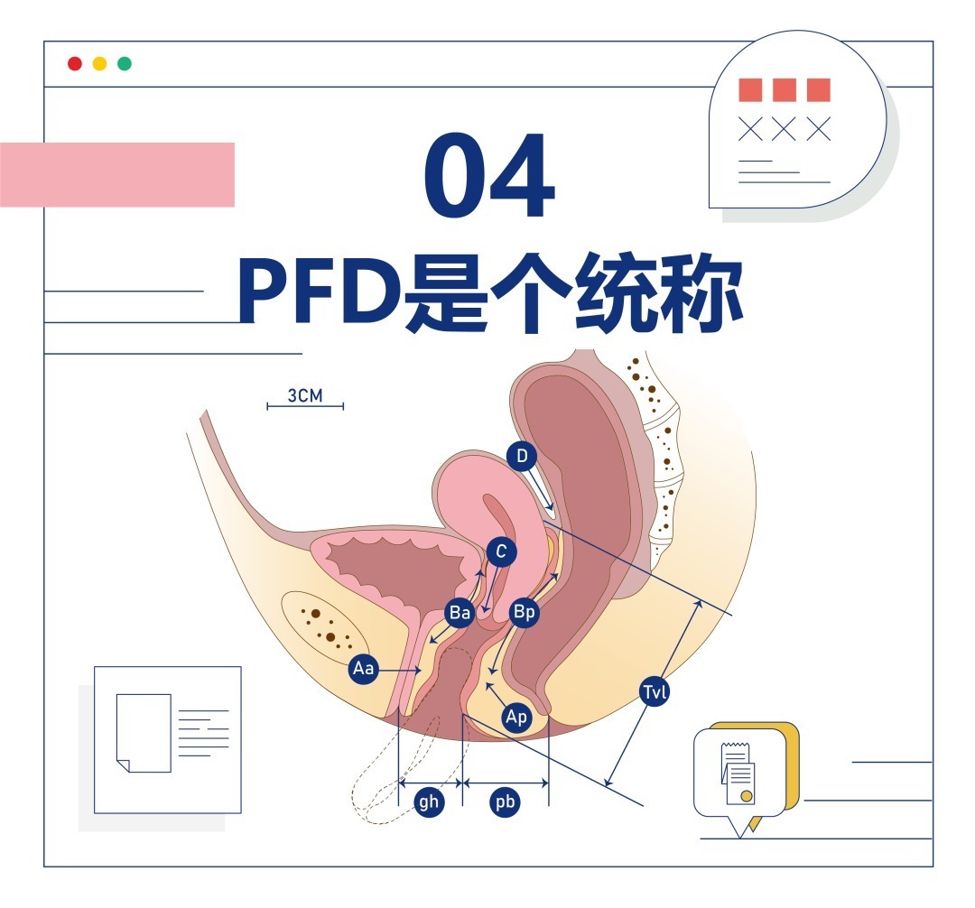 超有用的5个盆底小知识,第3个很多人不知道