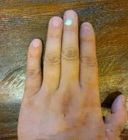 穴位|人体上居然还有“一键关机、一键清理”穴位,收藏以备不时之需!