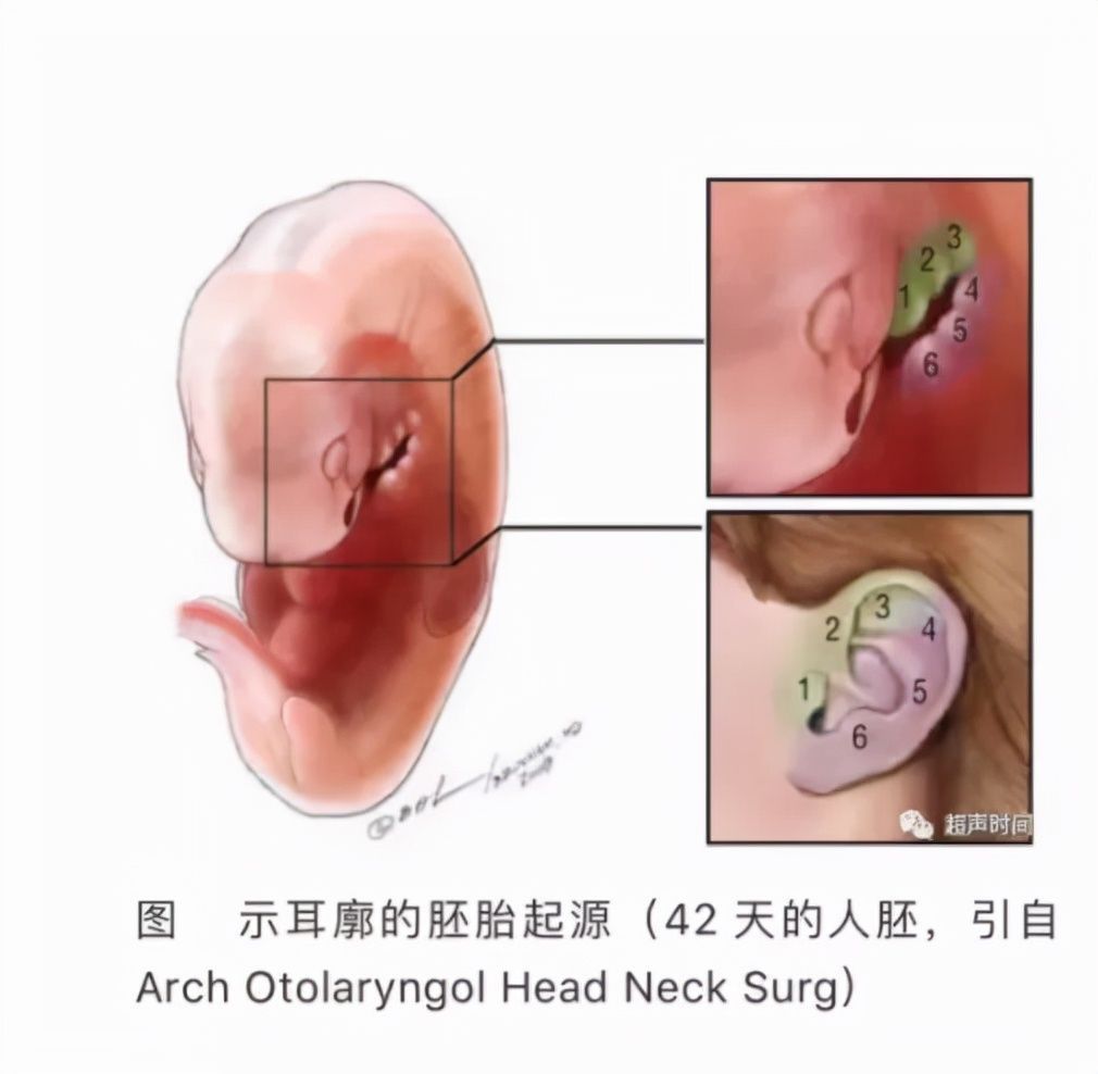 苗苗|听说耳朵长“聪明孔”，大富大贵还聪明？现实是，10岁女孩因它挨了刀