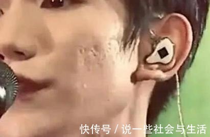 黑头 毛孔粗大难改善4种毛孔问题对症下药|医美科普!