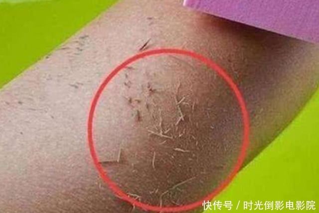 洗澡时搓出的黑泥是什么?显微镜不断放大后,终于看清楚了