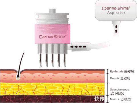 这些医美项目比你们所有的化妆品还有用!