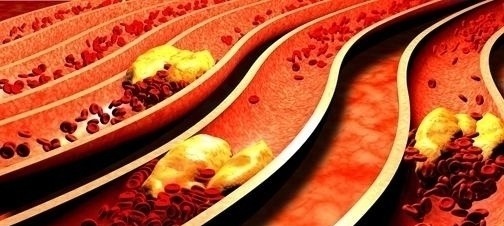 血液|“血液救命水”发现了,一天2口,干掉血栓,血液不脏,人变瘦!