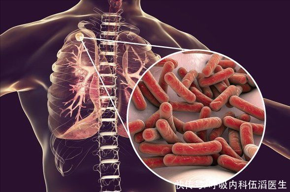 王明|肺癌已成中国第1癌!医生:一个部位反复感染,或许是肺癌的前兆