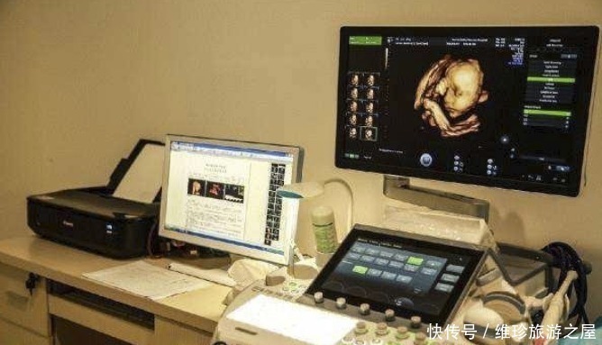 这些孕检项目,二胎孕妈要视其为“眼中钉”,千万不可掉以轻心