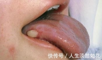 小刘|31岁男子因癌症入院,妻子:打针止痛药就可以了,医生竟认可