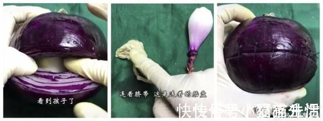 矫情|剖腹产比顺产轻松?看完这些“手术工具”,别再说女人“矫情”