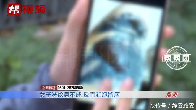 福建电视台|皮肤起泡化脓留疤,医生提醒,做这事得谨慎!