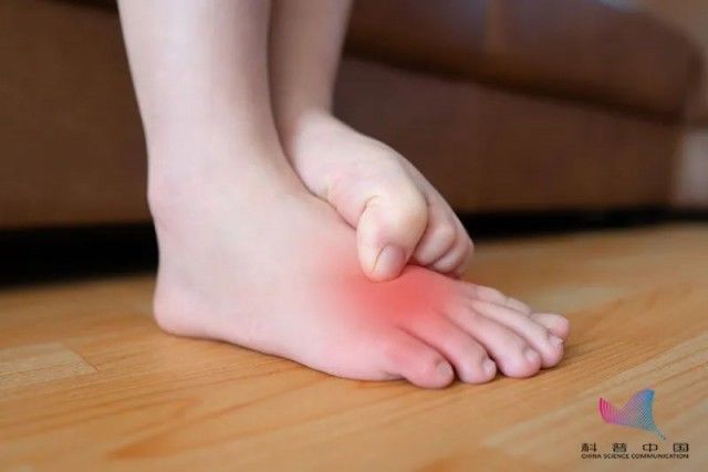 高跟鞋|女子爱穿尖头鞋竟患上这种“瘤”！不同脚型该怎么选鞋？今天说清楚了