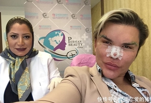 整得|33岁男子整容上瘾,花了百万巨资整容62次,鼻子被整得无法呼吸