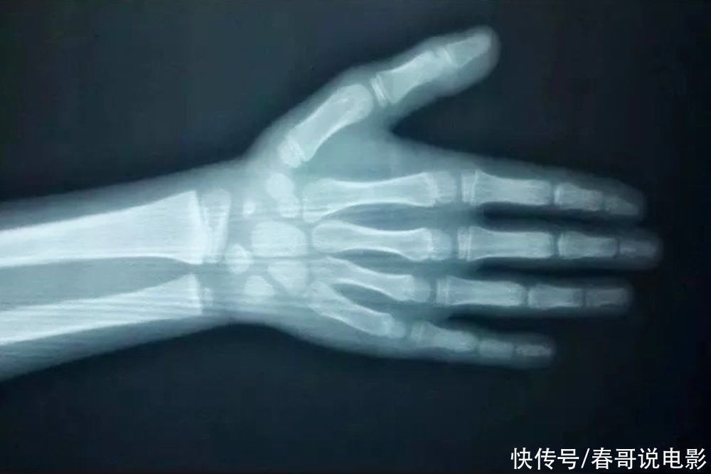 长高高|孩子如何长高高?这样做能延缓“骨龄”,让孩子长得又快又长又久