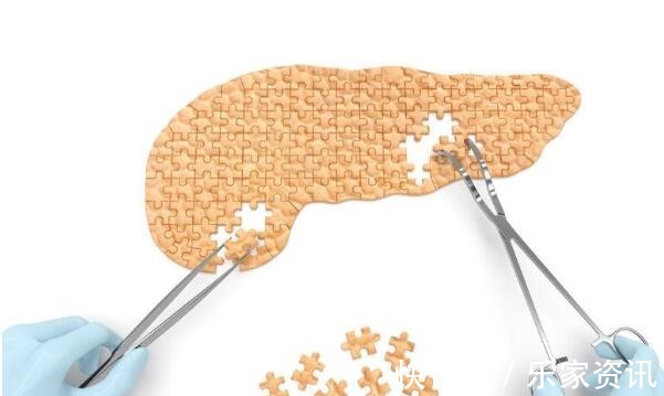 恶性肿瘤|胰腺癌不声不响医生这4个症状或是胰腺的“求救声”,要牢记