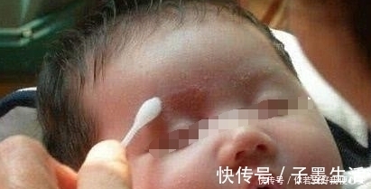 湿疹|25岁产妇剖宫产后坐月子,天气太冷只顾保暖,结果宝宝成了这样