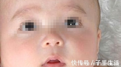 湿疹|25岁产妇剖宫产后坐月子,天气太冷只顾保暖,结果宝宝成了这样