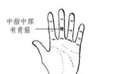 积滞|手上有一条青筋，没事刮一刮，可有效防治脑血栓！身体越来越棒！
